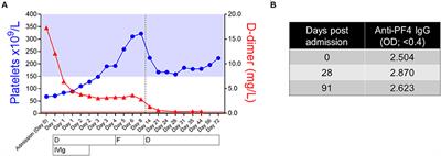 Case Report: Hypergranular Platelets in Vaccine-Induced Thrombotic Thrombocytopenia After ChAdOx1 nCov-19 Vaccination